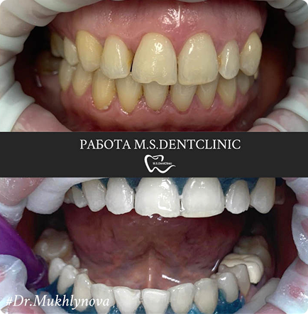 Tooth Icon