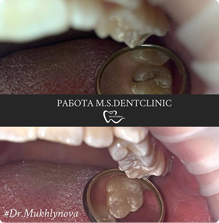 Tooth Icon